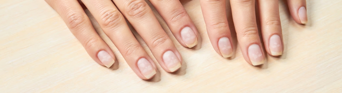 biale plamki na paznokciach